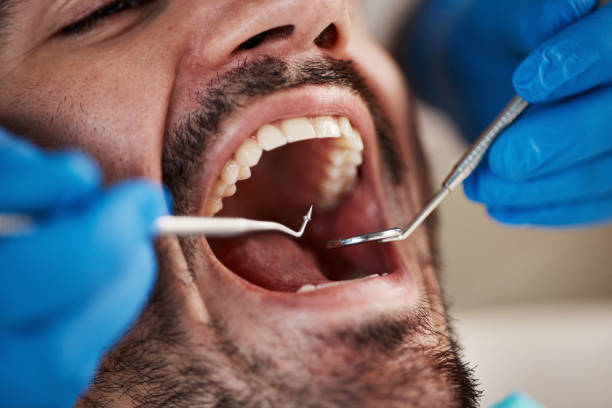 Best Emergency Treatment for Dental Infections or Abscesses in Kings Bay Base, GA